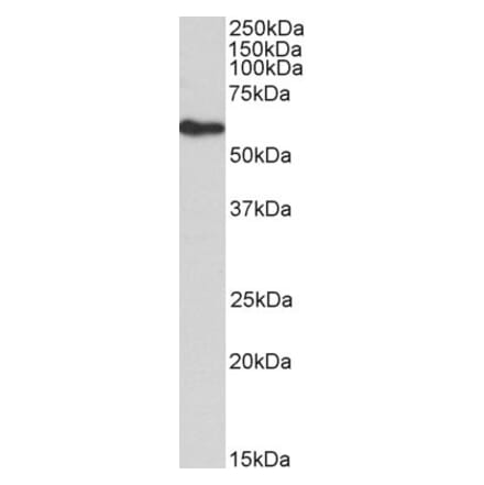 Western Blot - Anti-FRS2 Antibody (A83617) - Antibodies.com