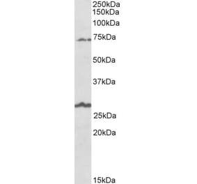 Western Blot - Anti-SLC6A12 Antibody (A83618) - Antibodies.com