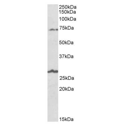 Western Blot - Anti-SLC6A12 Antibody (A83618) - Antibodies.com