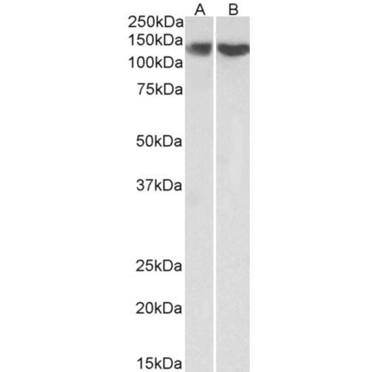 Western Blot - Anti-REST/NRSF Antibody (A83621) - Antibodies.com