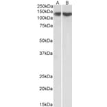 Western Blot - Anti-REST/NRSF Antibody (A83621) - Antibodies.com
