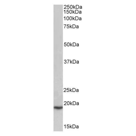 Western Blot - Anti-PLA2G2A Antibody (A83622) - Antibodies.com