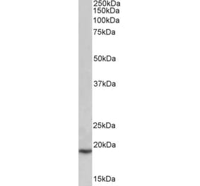 Western Blot - Anti-PLA2G2A Antibody (A83622) - Antibodies.com