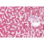 Immunohistochemistry - Anti-PLA2G2A Antibody (A83622) - Antibodies.com