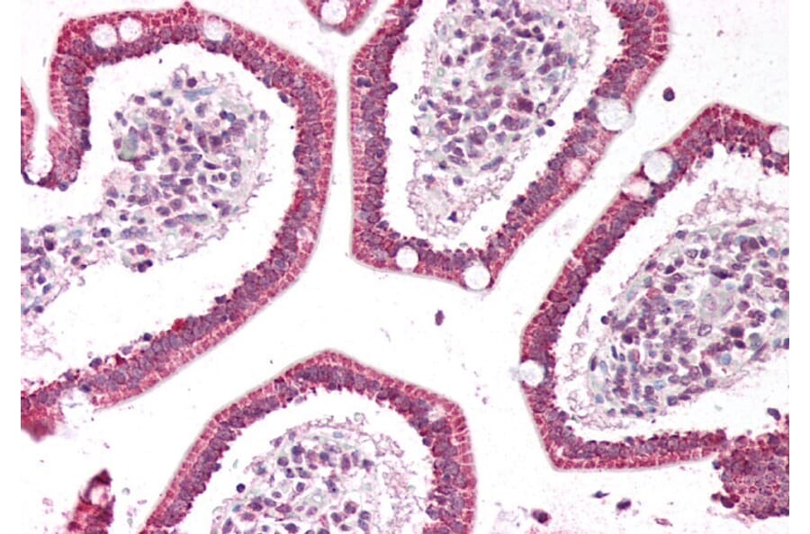 Immunohistochemistry - Anti-PLA2G2A Antibody (A83622) - Antibodies.com