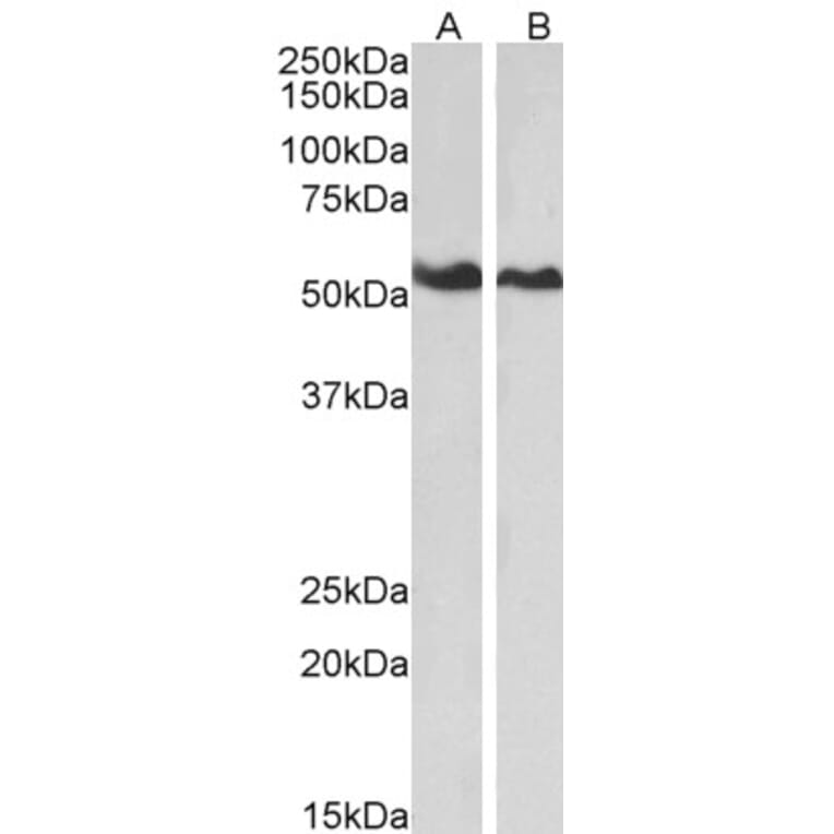 Western Blot - Anti-Annexin-11/ANXA11 Antibody (A83623) - Antibodies.com
