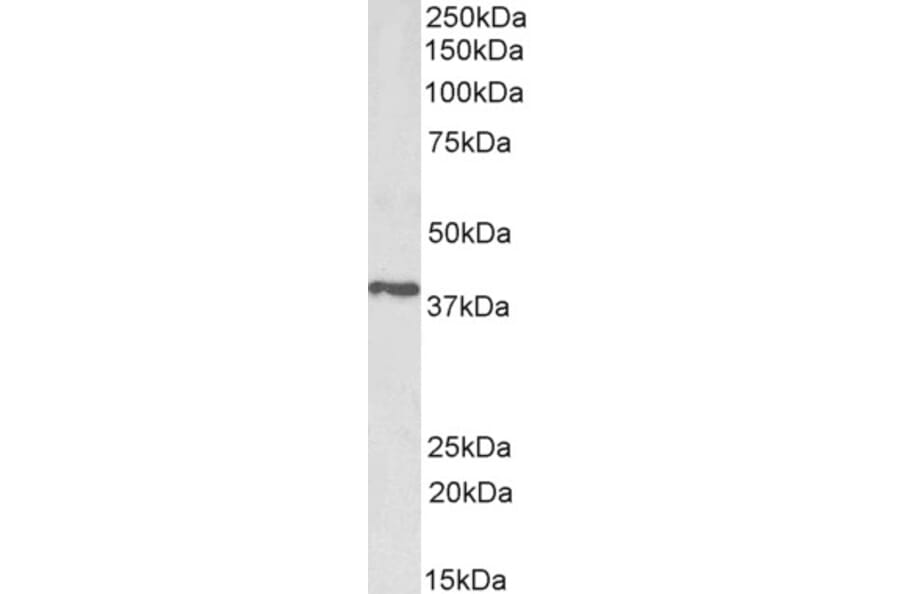 Western Blot - Anti-PTGR2 Antibody (A83624) - Antibodies.com