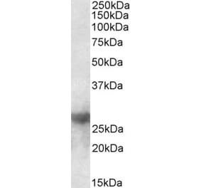 Western Blot - Anti-Galectin 3 Antibody (A83625) - Antibodies.com