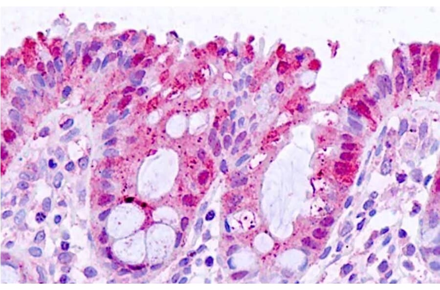 Immunohistochemistry - Anti-Galectin 3 Antibody (A83625) - Antibodies.com