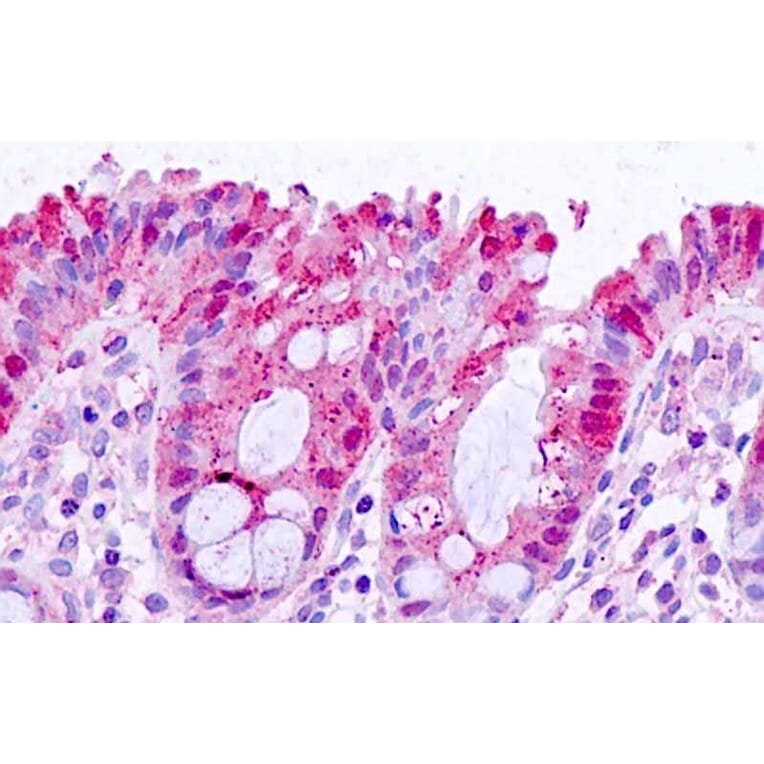 Immunohistochemistry - Anti-Galectin 3 Antibody (A83625) - Antibodies.com