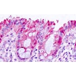 Immunohistochemistry - Anti-Galectin 3 Antibody (A83625) - Antibodies.com