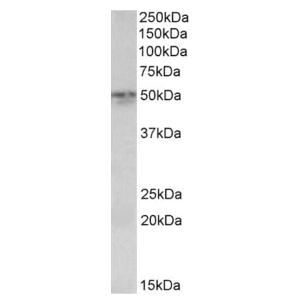 Western Blot - Anti-SYT2 Antibody (A83626) - Antibodies.com