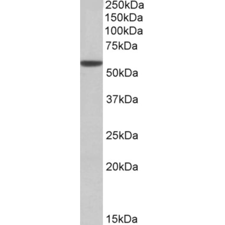 Western Blot - Anti-ALDH3A1 Antibody (A83627) - Antibodies.com