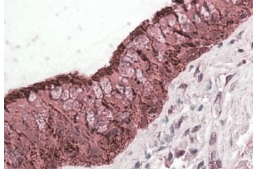 Immunohistochemistry - Anti-ALDH3A1 Antibody (A83627) - Antibodies.com