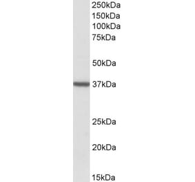 Western Blot - Anti-TOMM40 Antibody (A83628) - Antibodies.com