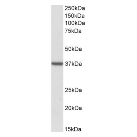 Western Blot - Anti-TOMM40 Antibody (A83628) - Antibodies.com