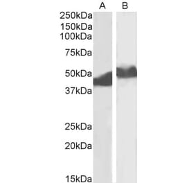 Western Blot - Anti-alpha 1 Antitrypsin Antibody (A83630) - Antibodies.com