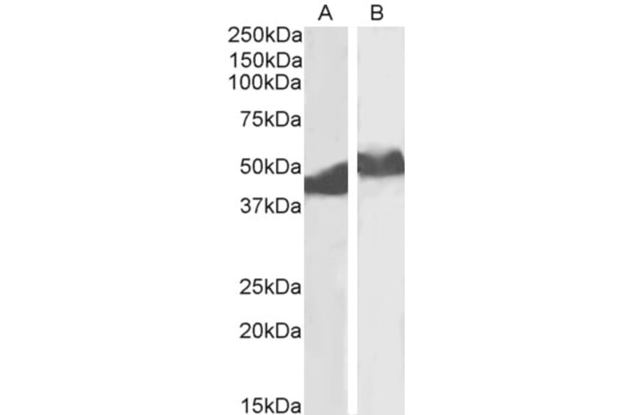 Western Blot - Anti-alpha 1 Antitrypsin Antibody (A83630) - Antibodies.com