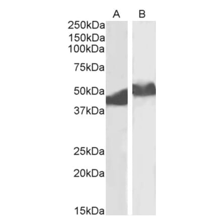 Western Blot - Anti-alpha 1 Antitrypsin Antibody (A83630) - Antibodies.com