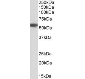 Western Blot - Anti-SERPINA1 Antibody (A83630) - Antibodies.com