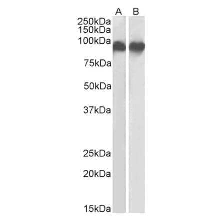 Western Blot - Anti-CD18 Antibody (A83631) - Antibodies.com