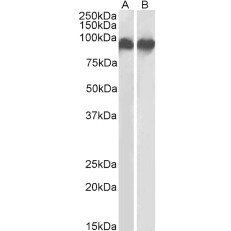 Western Blot - Anti-CD18 Antibody (A83631) - Antibodies.com