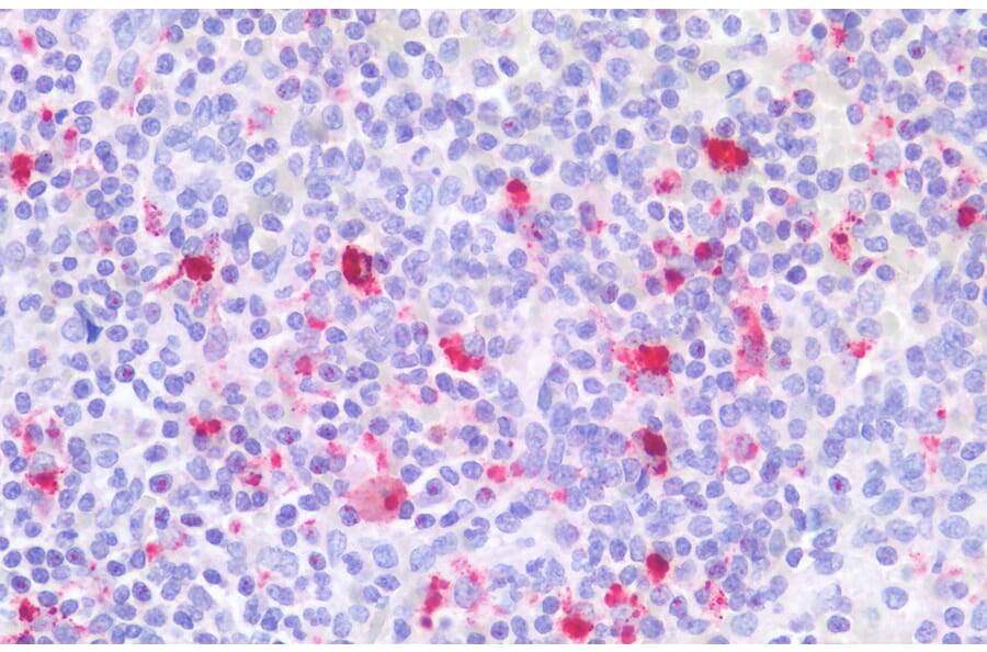 Immunohistochemistry - Anti-CD18 Antibody (A83631) - Antibodies.com