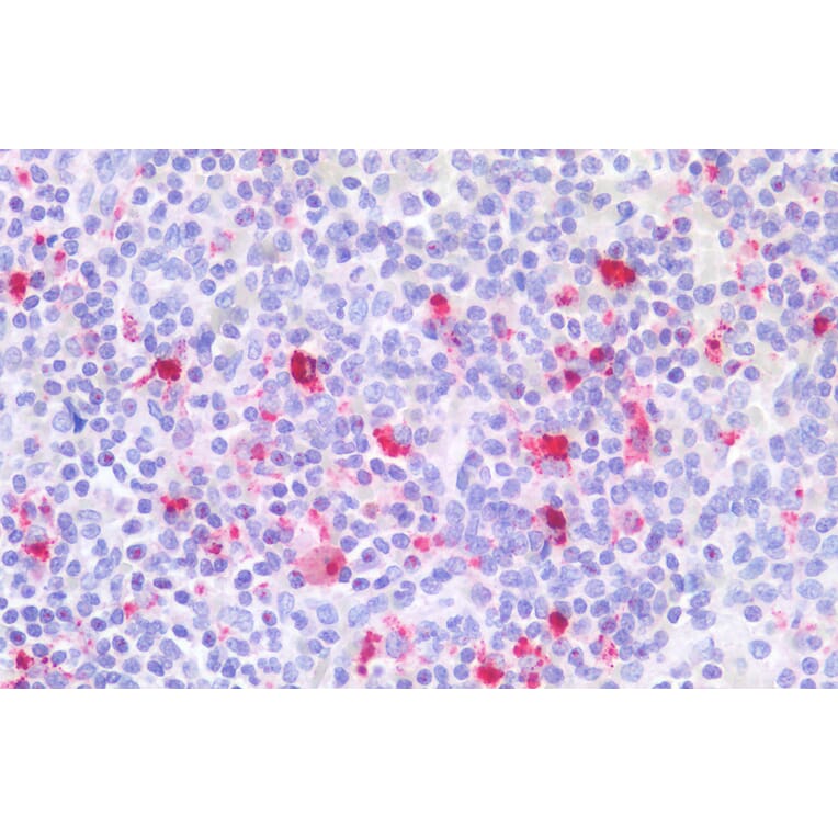 Immunohistochemistry - Anti-CD18 Antibody (A83631) - Antibodies.com