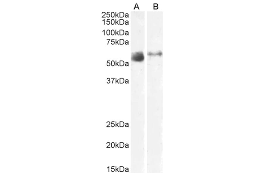 Western Blot - Anti-SLC7A7 Antibody (A83632) - Antibodies.com