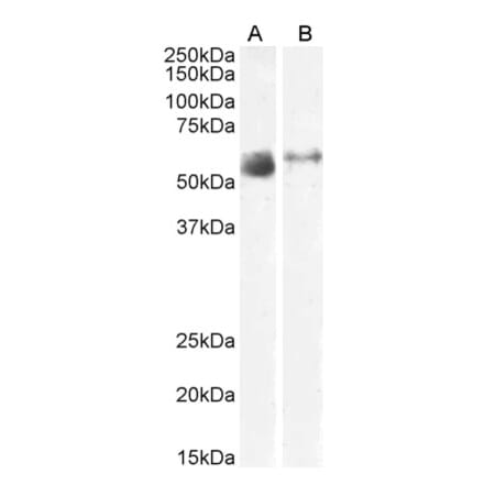Western Blot - Anti-SLC7A7 Antibody (A83632) - Antibodies.com