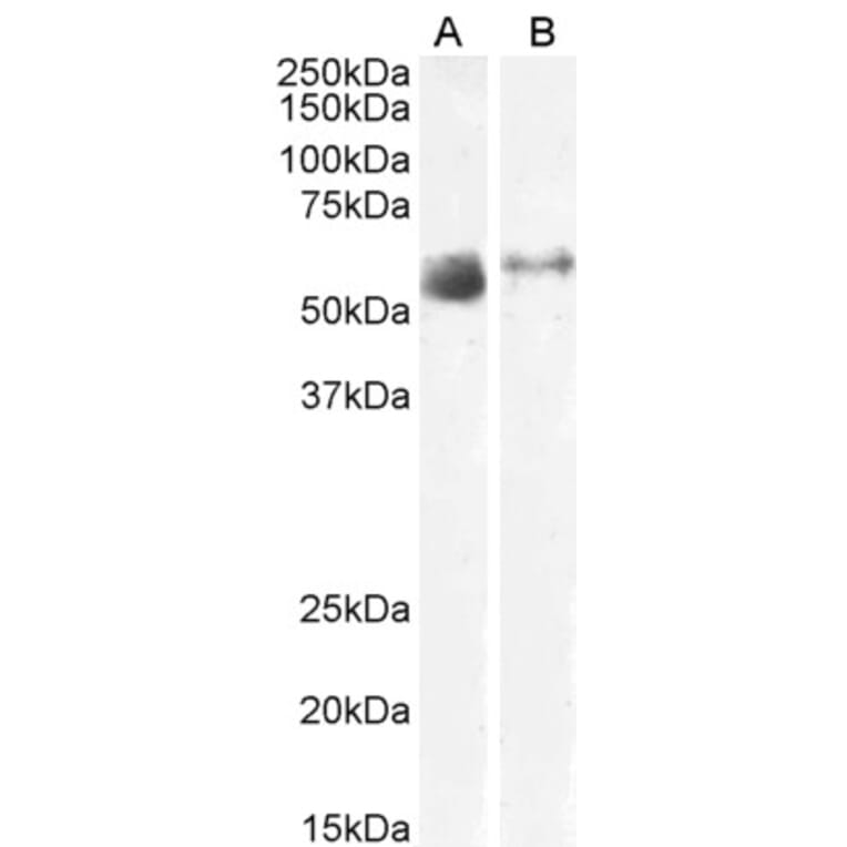 Western Blot - Anti-SLC7A7 Antibody (A83632) - Antibodies.com