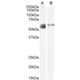 Western Blot - Anti-SLC7A7 Antibody (A83632) - Antibodies.com
