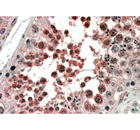 Immunohistochemistry - Anti-Activin Receptor Type I Antibody (A83633) - Antibodies.com