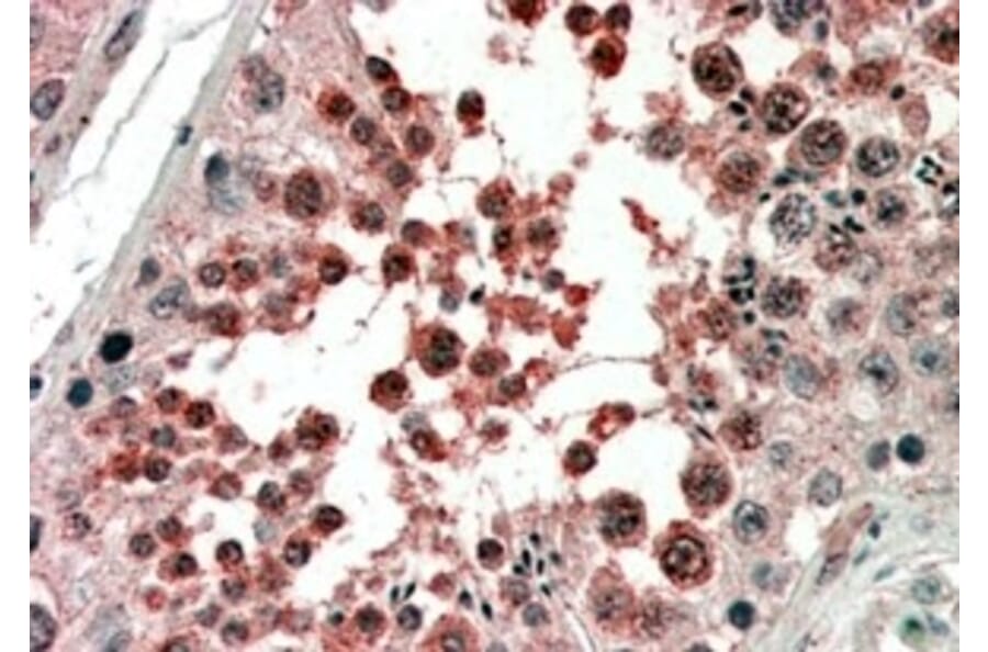 Immunohistochemistry - Anti-Activin Receptor Type I Antibody (A83633) - Antibodies.com