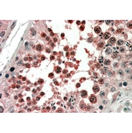 Immunohistochemistry - Anti-Activin Receptor Type I Antibody (A83633) - Antibodies.com