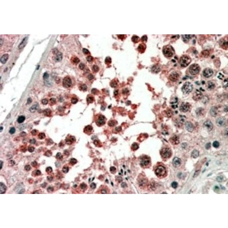 Immunohistochemistry - Anti-Activin Receptor Type I Antibody (A83633) - Antibodies.com