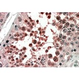 Immunohistochemistry - Anti-Activin Receptor Type I Antibody (A83633) - Antibodies.com