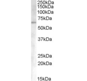 Western Blot - Anti-ACVR1 Antibody (A83633) - Antibodies.com