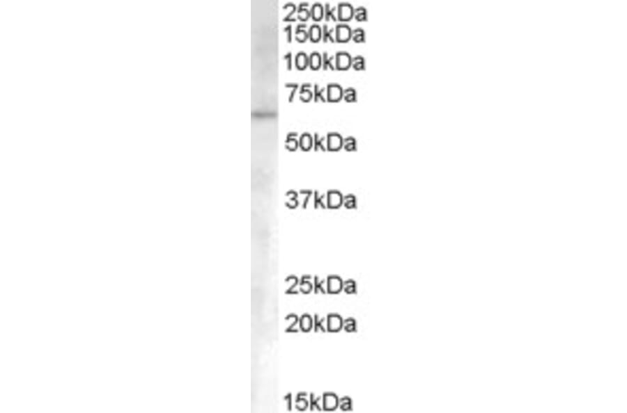Western Blot - Anti-Activin Receptor Type I Antibody (A83633) - Antibodies.com