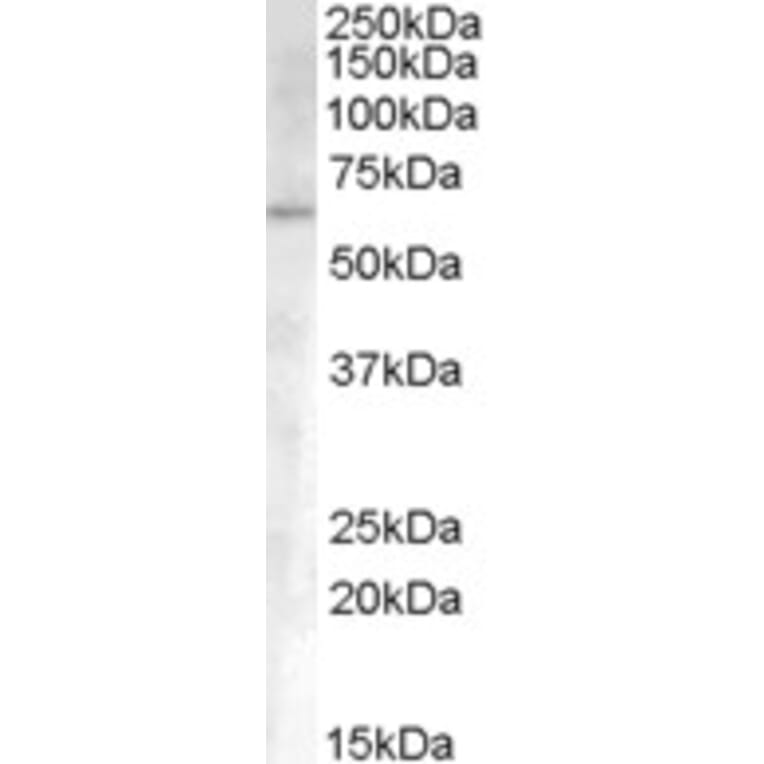 Western Blot - Anti-Activin Receptor Type I Antibody (A83633) - Antibodies.com