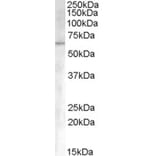 Western Blot - Anti-Activin Receptor Type I Antibody (A83633) - Antibodies.com