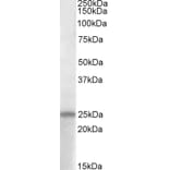 Western Blot - Anti-PACAP-38 Antibody (A83635) - Antibodies.com