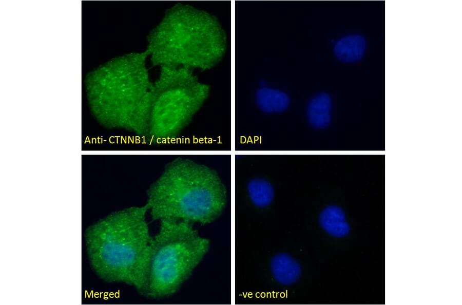 Immunofluorescence - Anti-beta Catenin Antibody (A83637) - Antibodies.com