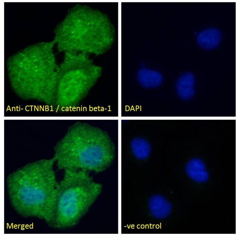 Immunofluorescence - Anti-beta Catenin Antibody (A83637) - Antibodies.com