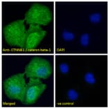 Immunofluorescence - Anti-beta Catenin Antibody (A83637) - Antibodies.com