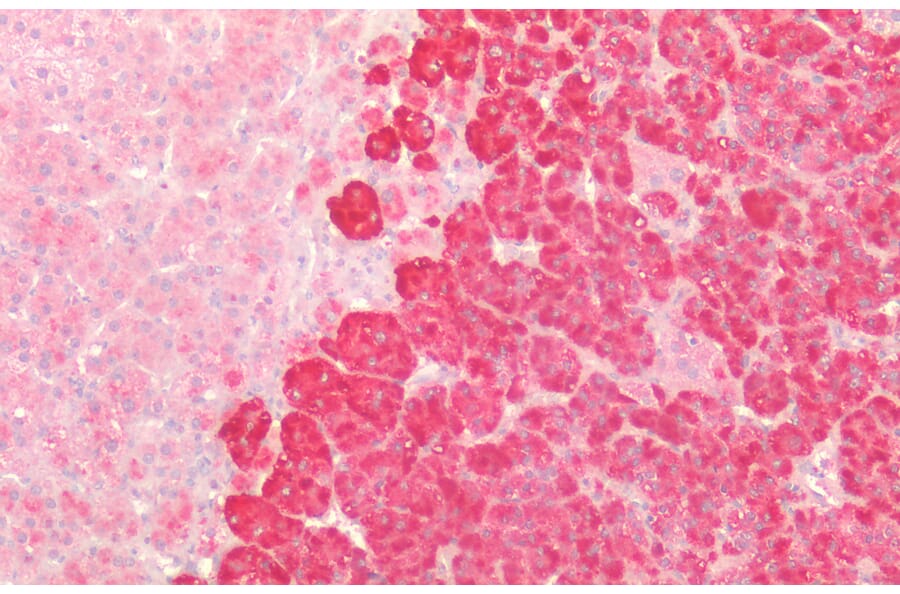 Immunohistochemistry - Anti-beta Catenin Antibody (A83637) - Antibodies.com