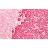 Immunohistochemistry - Anti-beta Catenin Antibody (A83637) - Antibodies.com