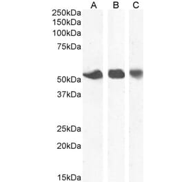 Western Blot - Anti-ENT1 Antibody (A83640) - Antibodies.com