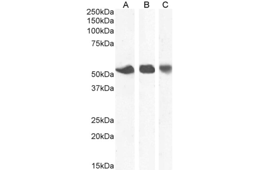 Western Blot - Anti-ENT1 Antibody (A83640) - Antibodies.com