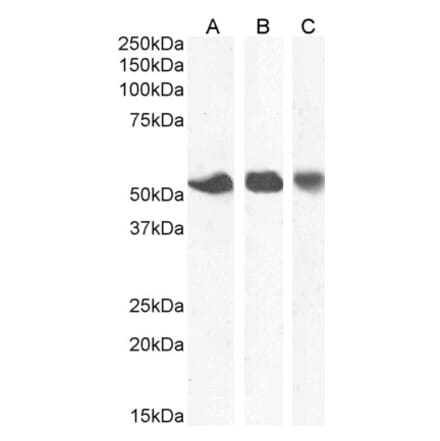 Western Blot - Anti-ENT1 Antibody (A83640) - Antibodies.com